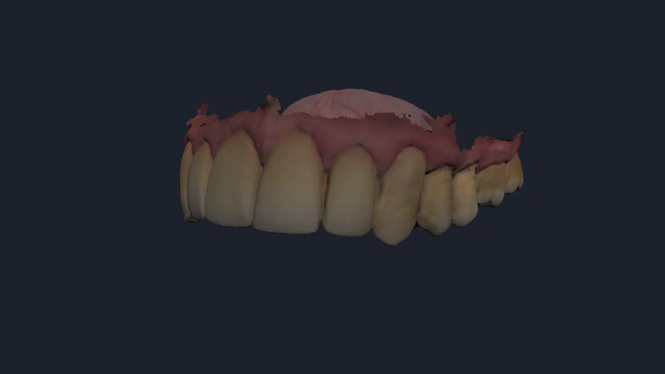 Visualizador 3D do KAFLOW exibindo o modelo digital de uma arcada superior.